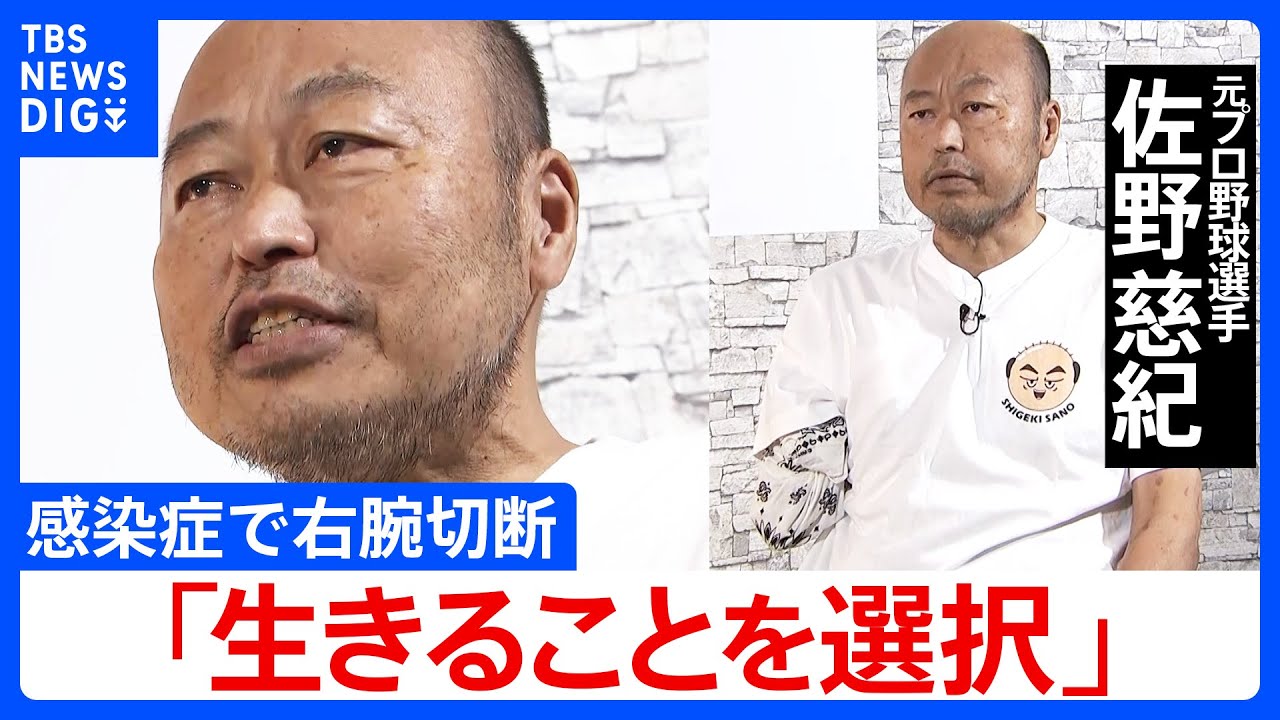 「指先が黒く壊死して…」元プロ野球選手の佐野慈紀さん 生きるために“共に闘った右腕”を切断 それでも表に出続ける意味 | TBS NEWS DIG