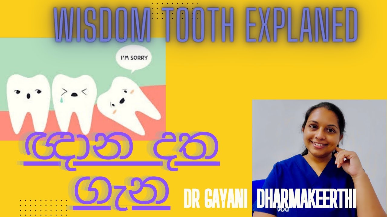 ඥාන දත ගැන | wisdom tooth explained | Happy Family Dental Surgery | Happy Family SL | Srilanka