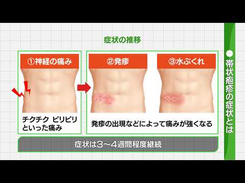 【帯状疱疹】高齢者の注意すべき感染症③帯状疱疹の原因と予防