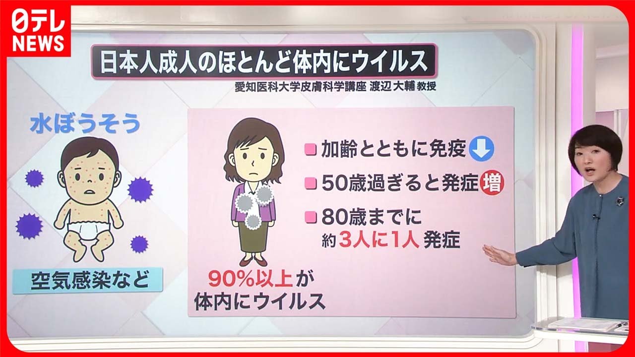 【解説】この時期に気をつけたい「帯状疱疹」  若い世代でなぜ増えた？『知りたいッ！』