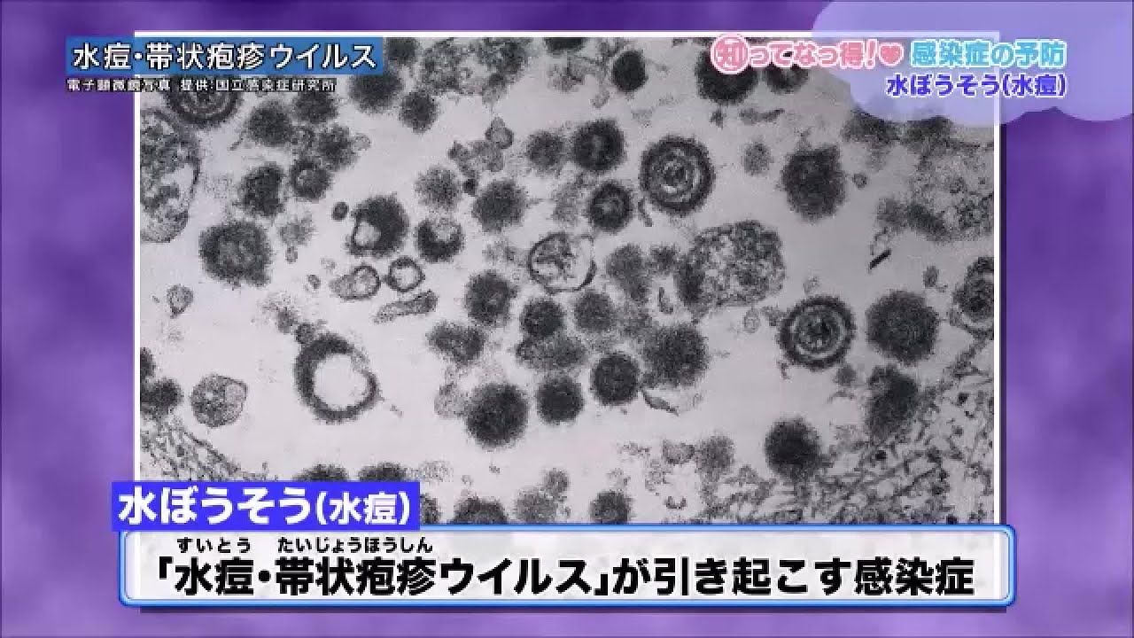 水ぼうそう「知ってなっ得！感染症の予防＃１その５」
