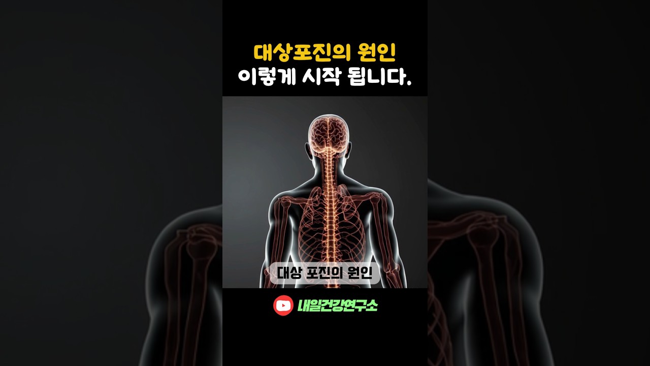 대상포진의 원인