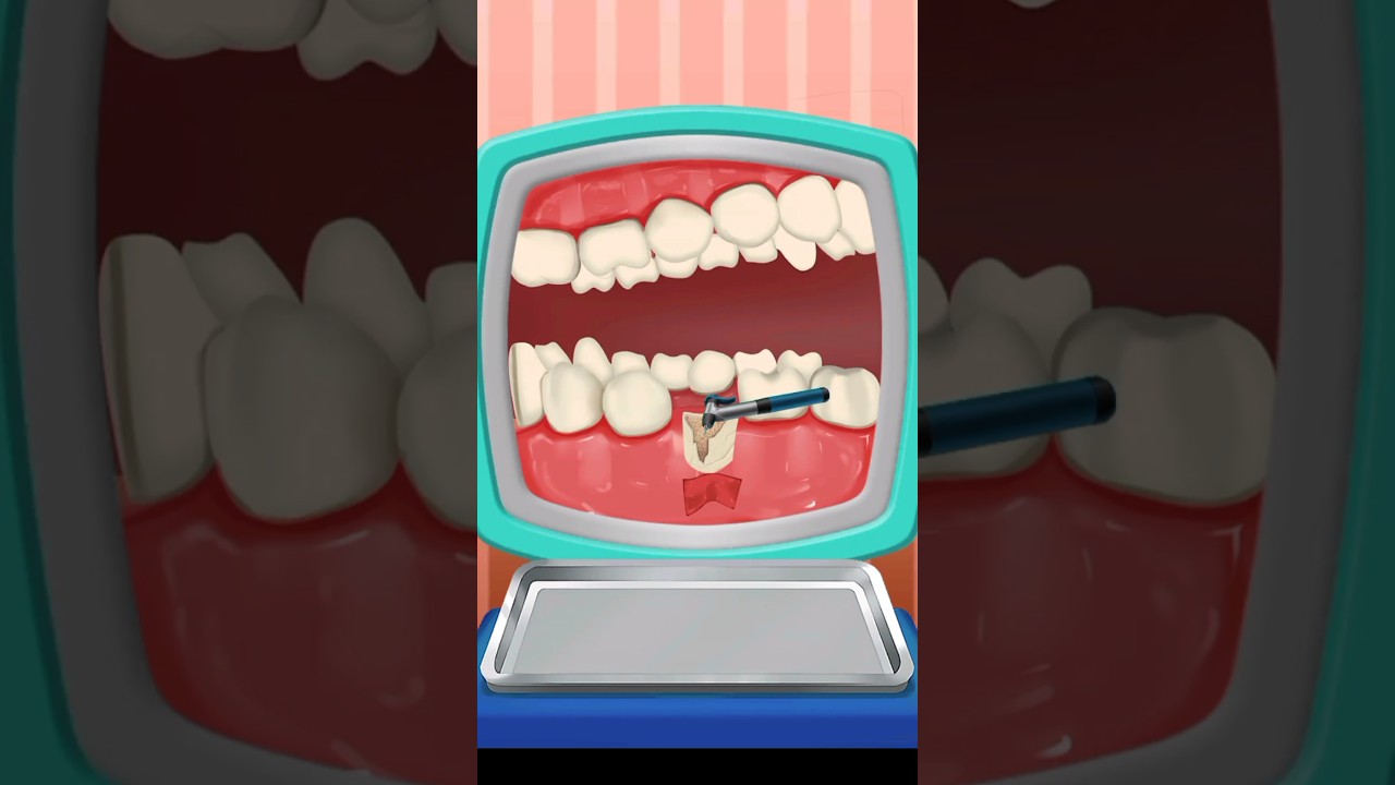 दांत dental animation #shortvideo #trending ASMR #shortvideo