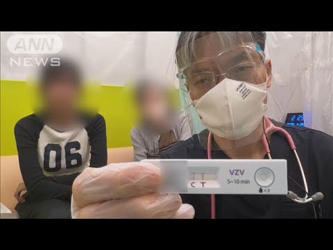 水ぼうそう異例の流行　大人も警戒【知っておきたい！】【グッド！モーニング】(2025年5月18日)