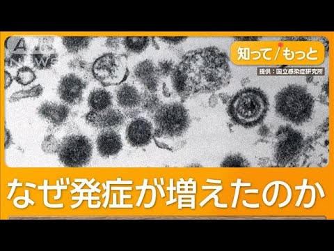帯状疱疹のワクチン定期接種へ　50代から急増　激しい痛み「顔面神経まひ」「失明」も【もっと知りたい！】【グッド！モーニング】(2024年12月22日)