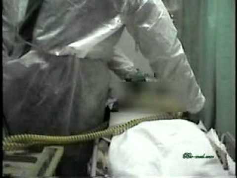 911Biomed - Crashing