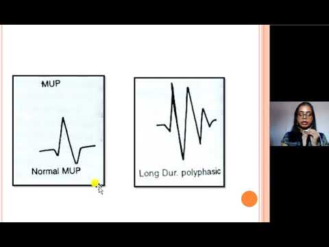 abnormal MUPS Dr Srishti Banerjee