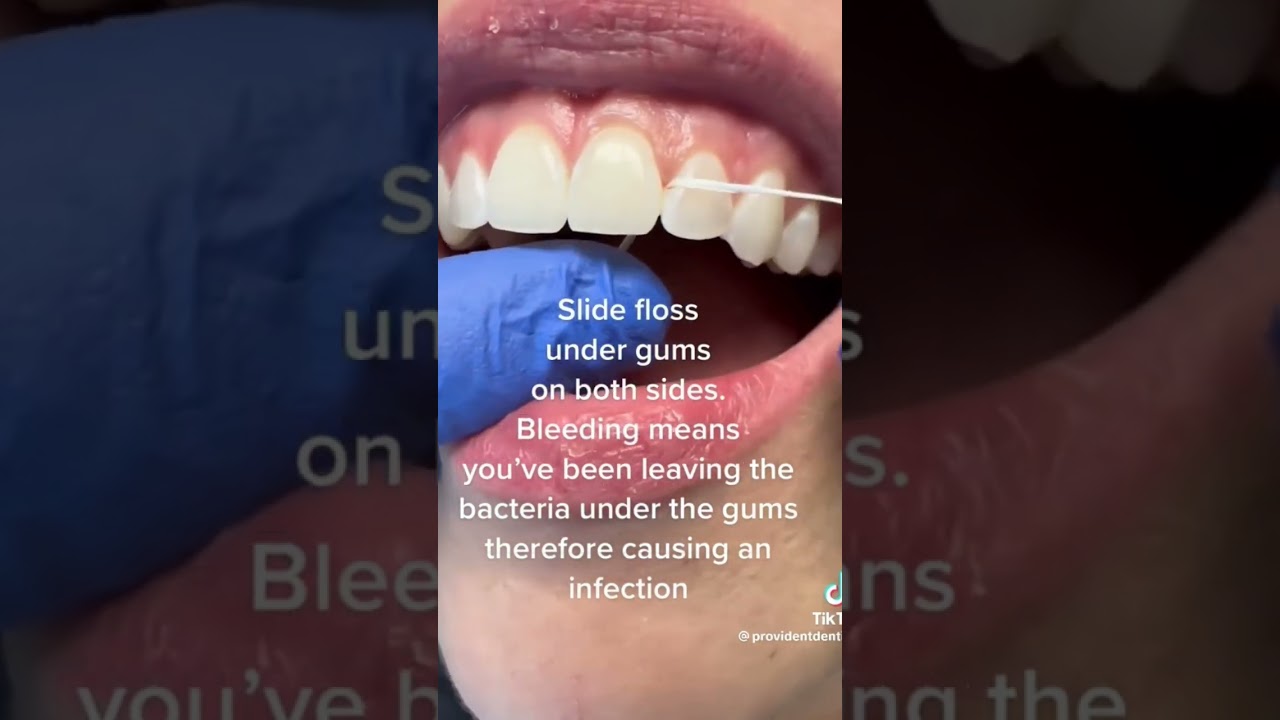 Are you flossing properly? #dentaltips #dentaleducation