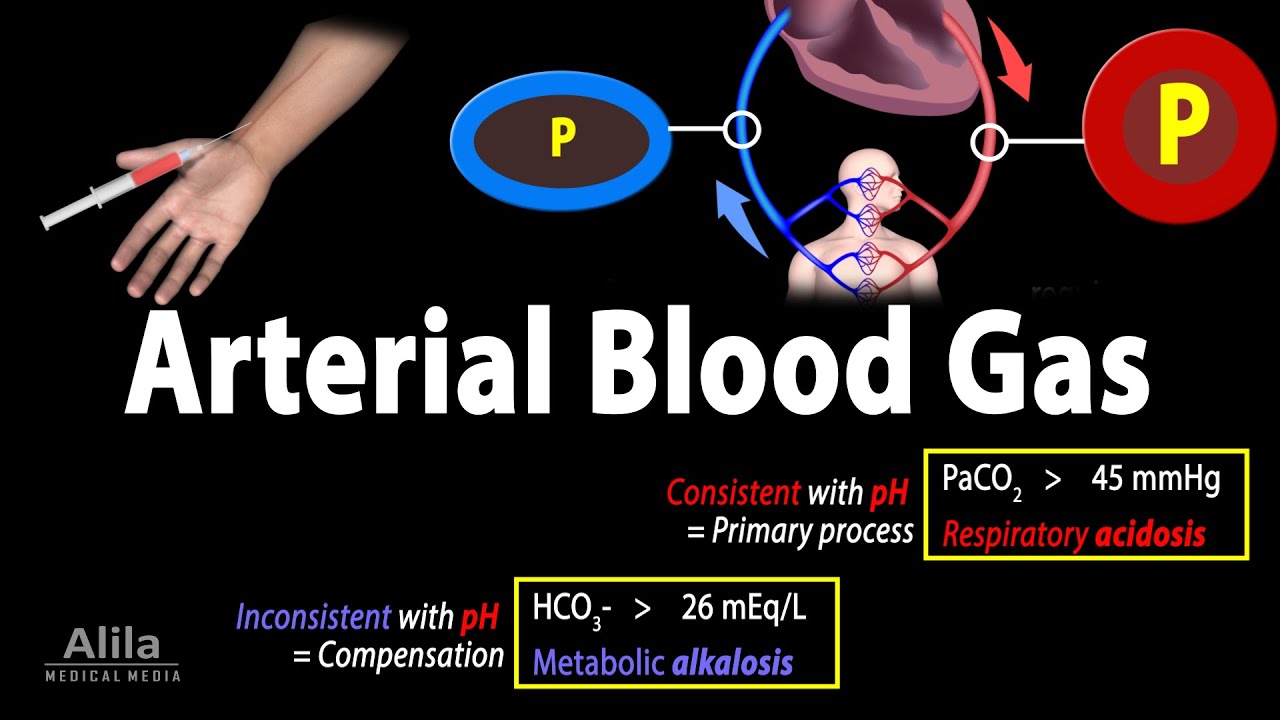 Arterial Blood Gas (ABG) Test, Animation