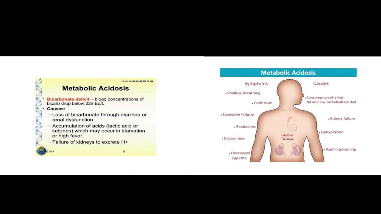 Arterial blood gases ABG pt.2 - cath lab guider