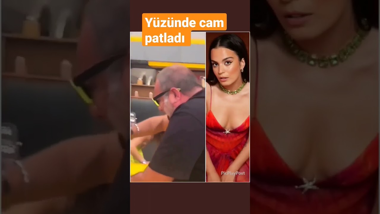 Aslı Bekiroğlu'nun yüzünde cam sebil patladı