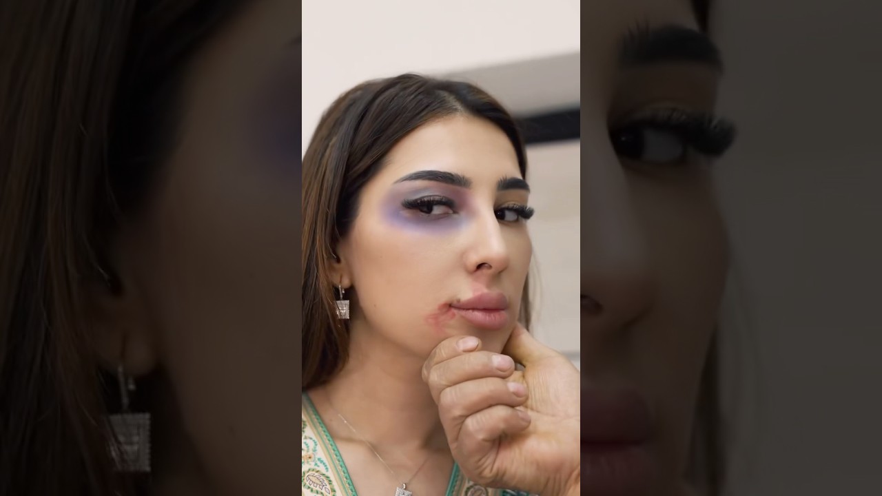 Ayib o’zizda 🥺 | #chechenka