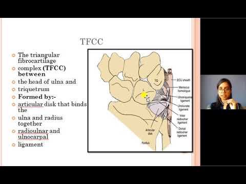 Biomechanic of wrist  1 by Dr Srishti Banerjee