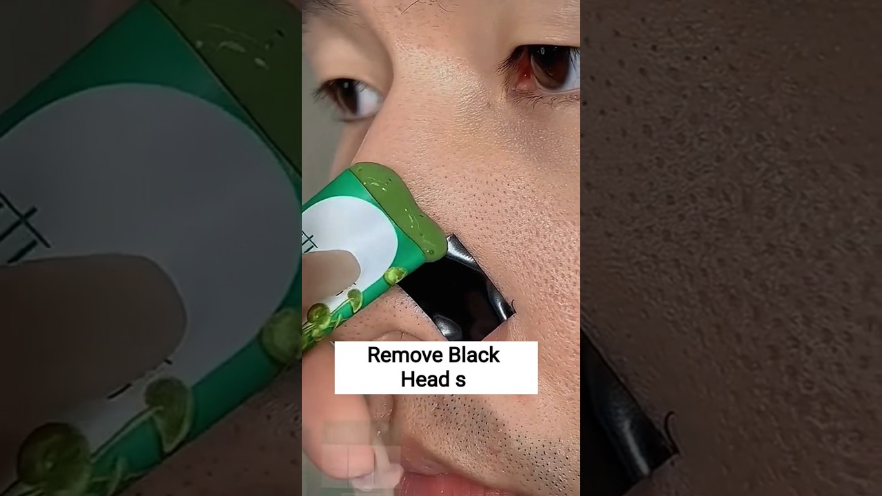 Black Head Removal nose mask#blackheadremoval #skincare #ytshorts #viralvideo #viralshorts