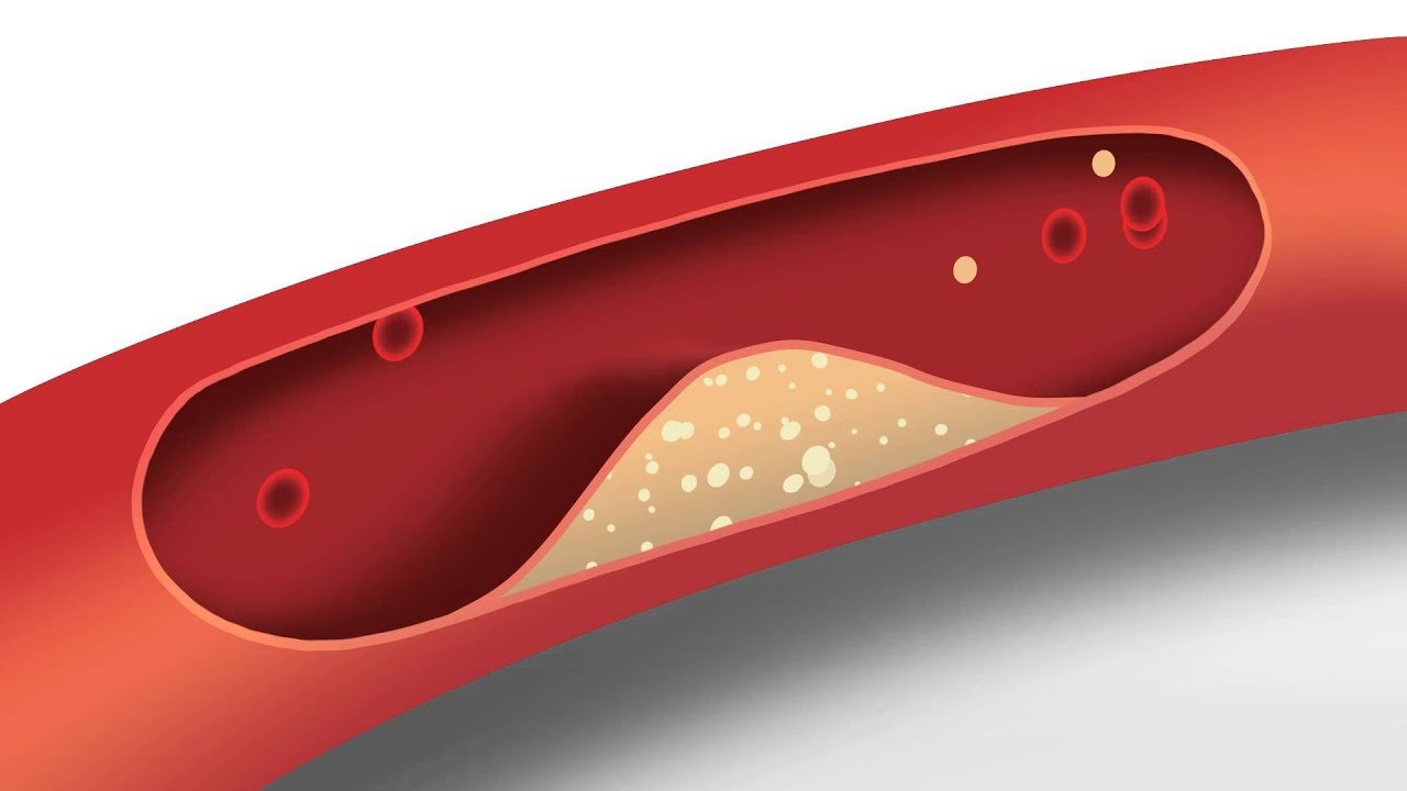 Blood Pressure Animation | Heart disease risk factors