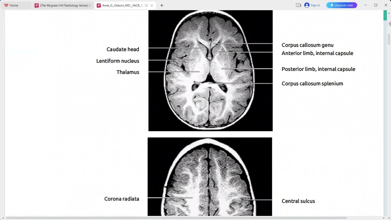 BRAIN AND SPINE ANATOMY