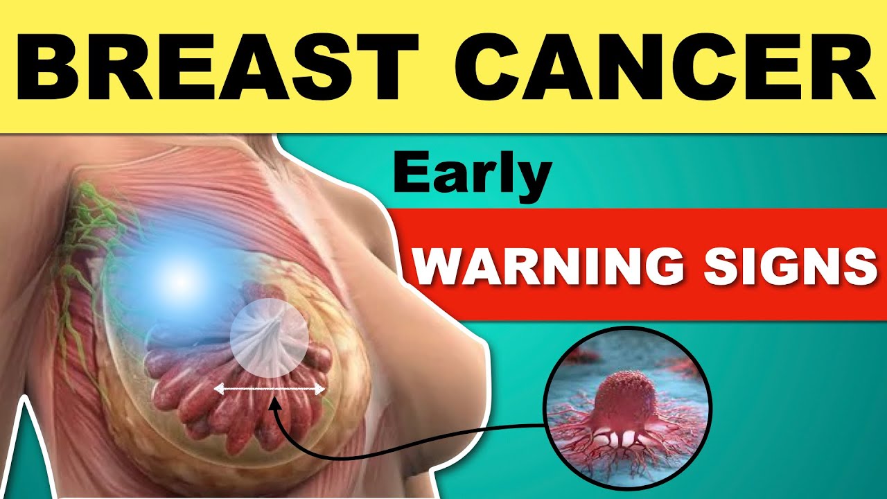 Breast Cancer Symptoms | Early Warning Signs of Breast Cancer | Breast Examination