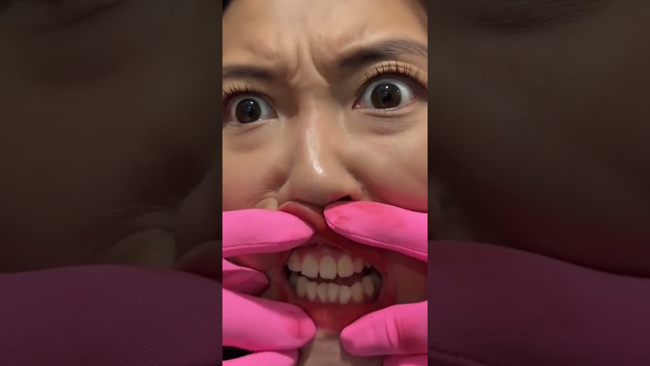 Brushie - Lười đánh răng và cái kết, Phần 2