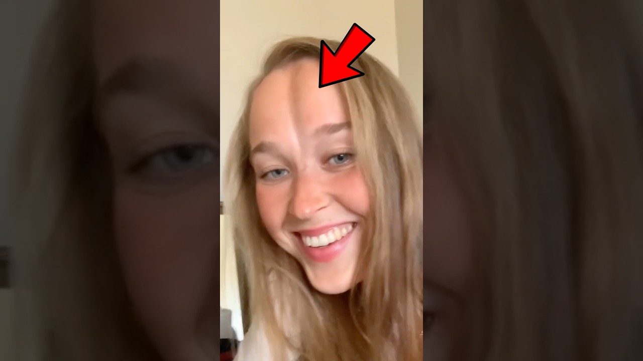 Butt Forehead