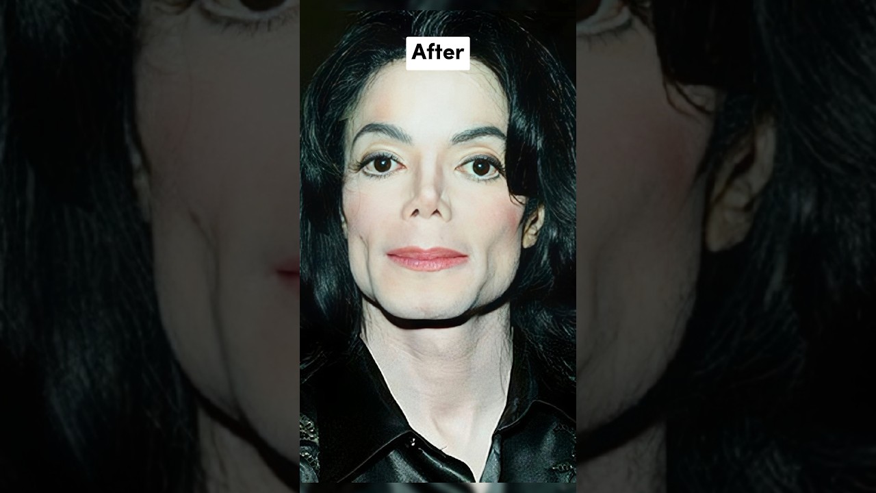 Celebrities Before And After Plastic Surgery 🔥🔥pt2 #shorts #viral
