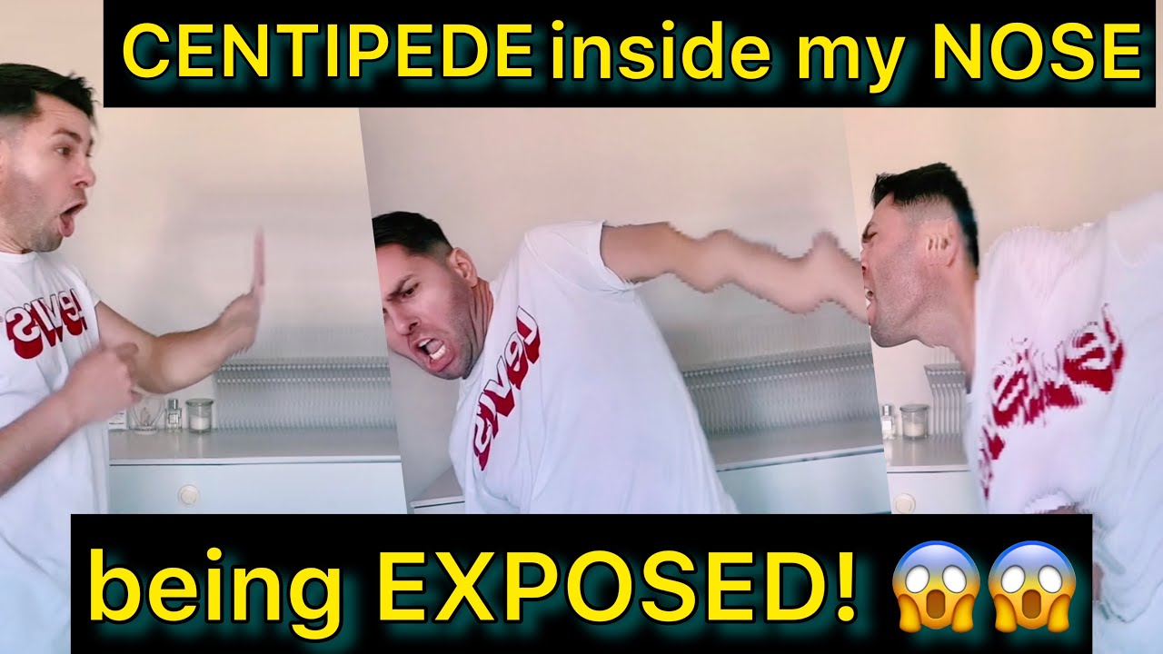 CENTIPEDE LIVING INSIDE MY NOSE #meme #comedy #funny #viral #cartoon #animation #india #usa #france