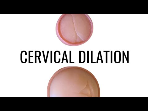 Cervical Dilation - up close!!