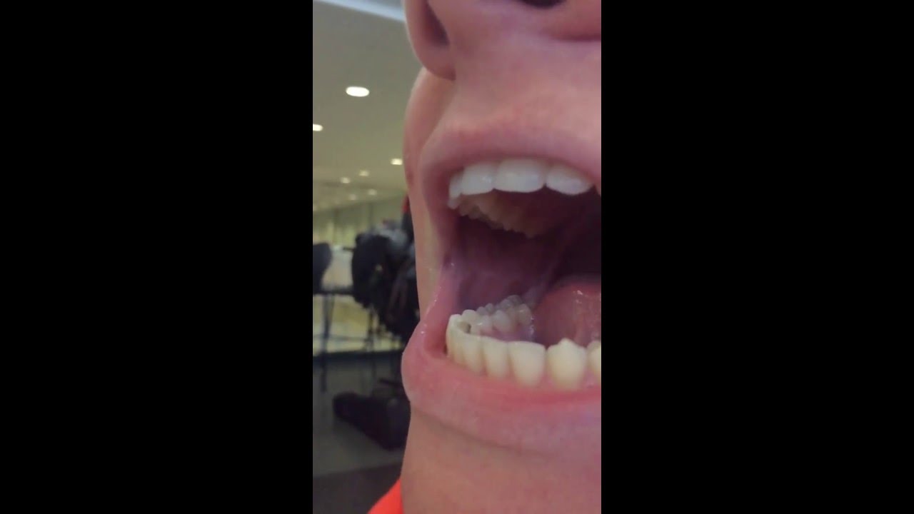 Close up of a Gleek (Slo-Mo)