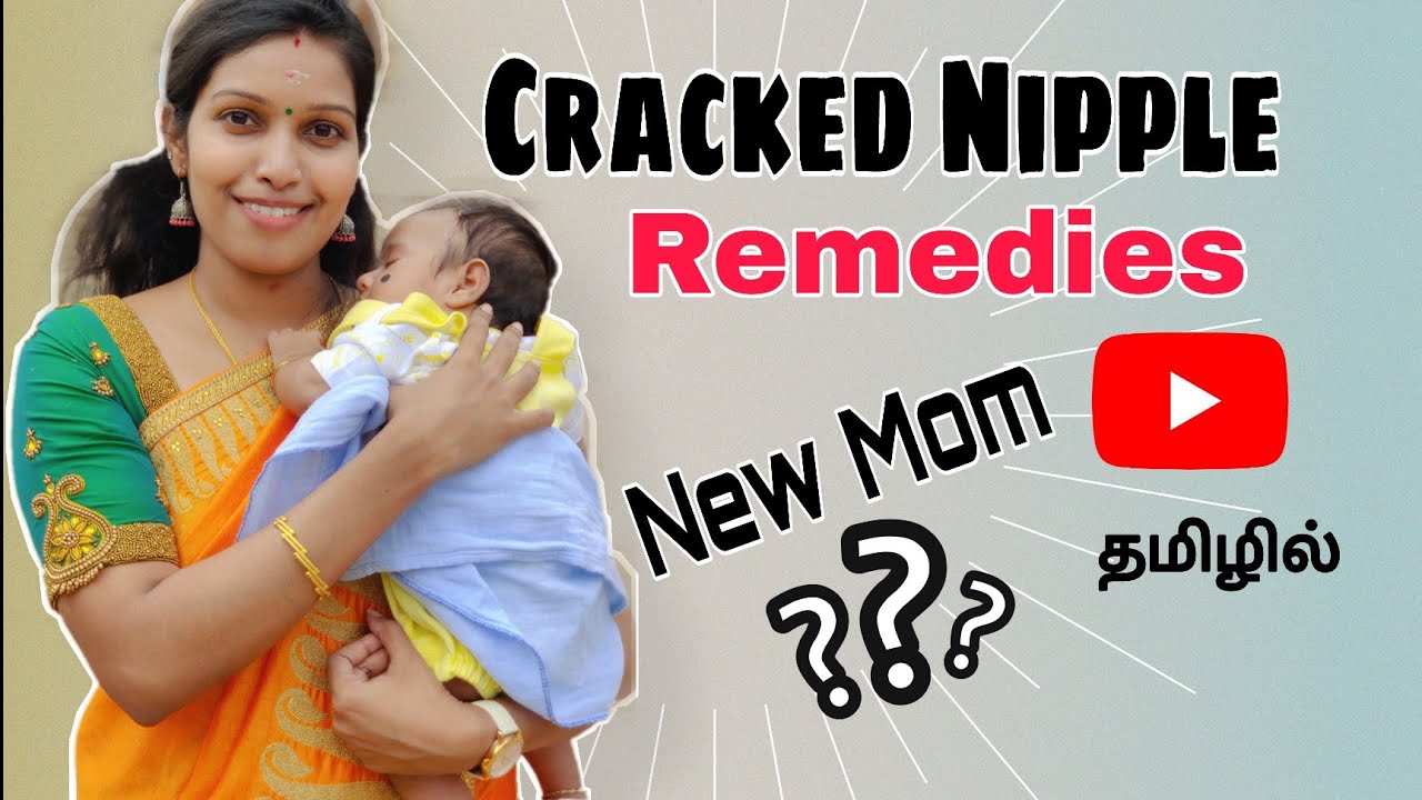 Cracked Nipple Remedies | Nipple Crack in Breastfeeding | Tamil