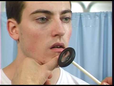 Cranial Nerves Examination Trailer