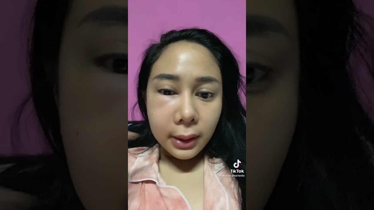 Denise Chariesta babak belur dibikin Dewi  persik#shorts