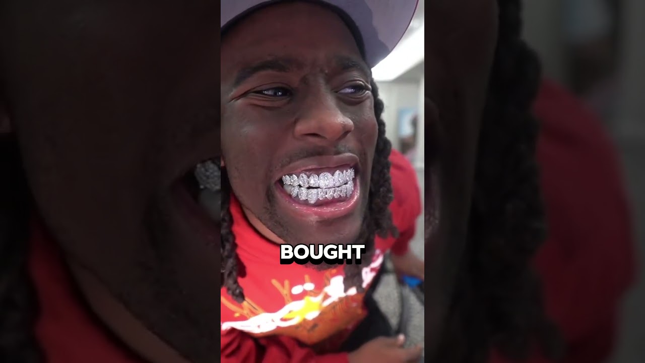 Diamond Teeth! 💎🦷