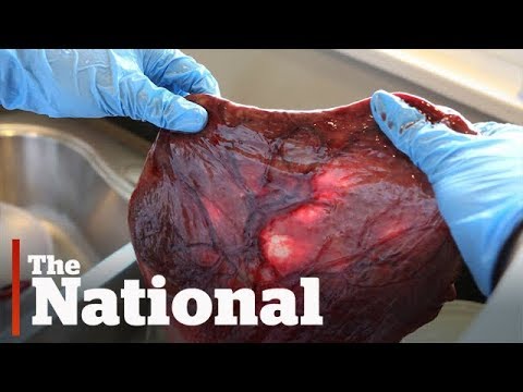 Don't eat placenta, medical experts say