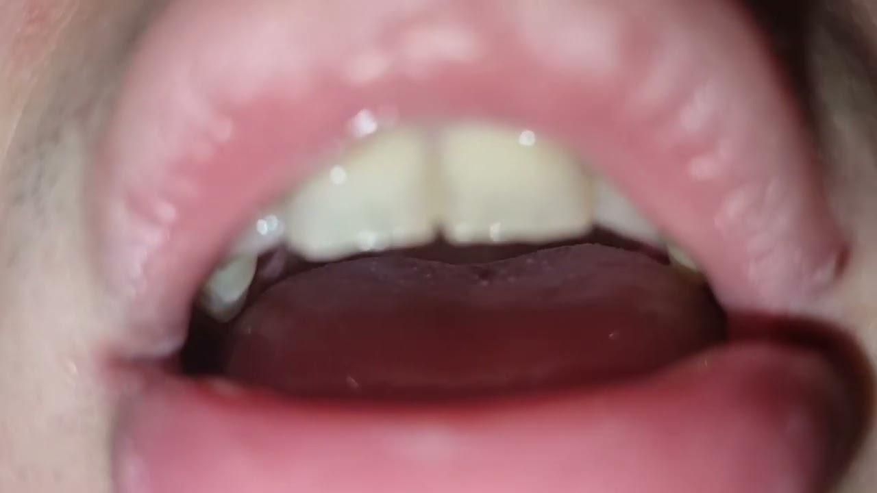 Eating Gummy Candy Vore