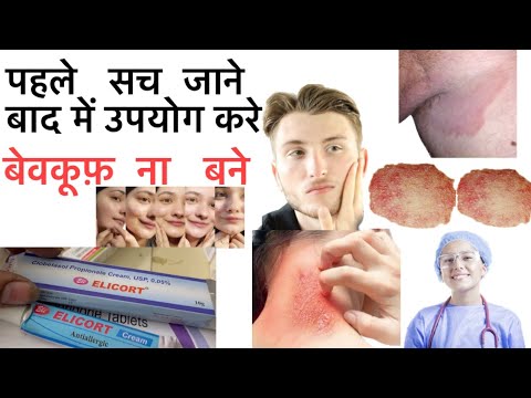 ELICORT cream review | benefits and side effects use in hindi #elicort