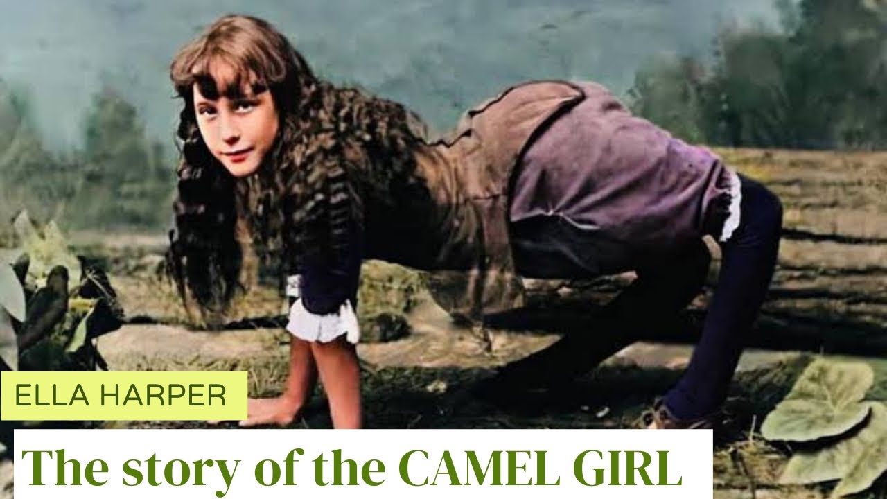 Ella Harper: The Shocking True story of the “CAMEL GIRL”😱😱😳😲