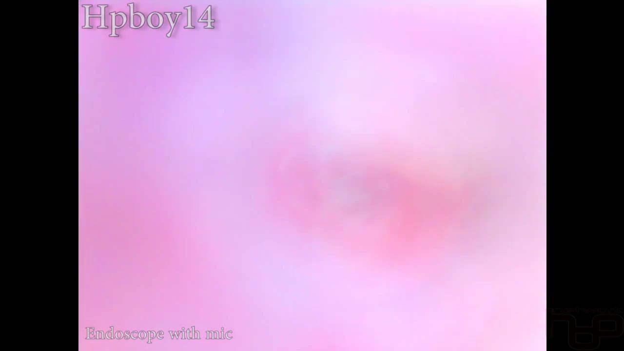 [Endoscope] - My Noisy Guts - Swallowed Mic