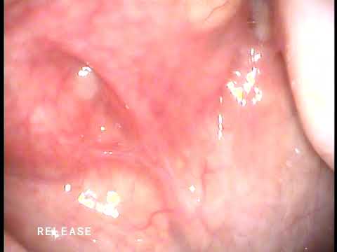 Endoscopy - July 1, 2015