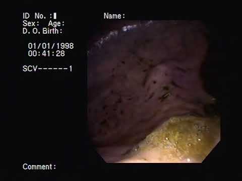 Equine Stomach Endoscopy Vore