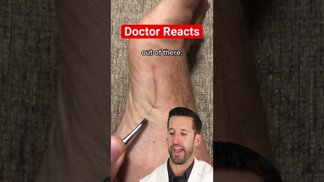 ER Doctor REACTS to 