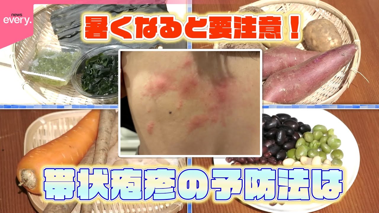 【激痛】暑くなると要注意！帯状疱疹の予防には「ワクチン接種」と「免疫力維持」…専門家が勧める運動法と食事“具だくさんみそ汁”『every.特集』