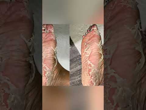 FOOT PEEL MASK #Shorts #footpeel #footpeelmask #footmask