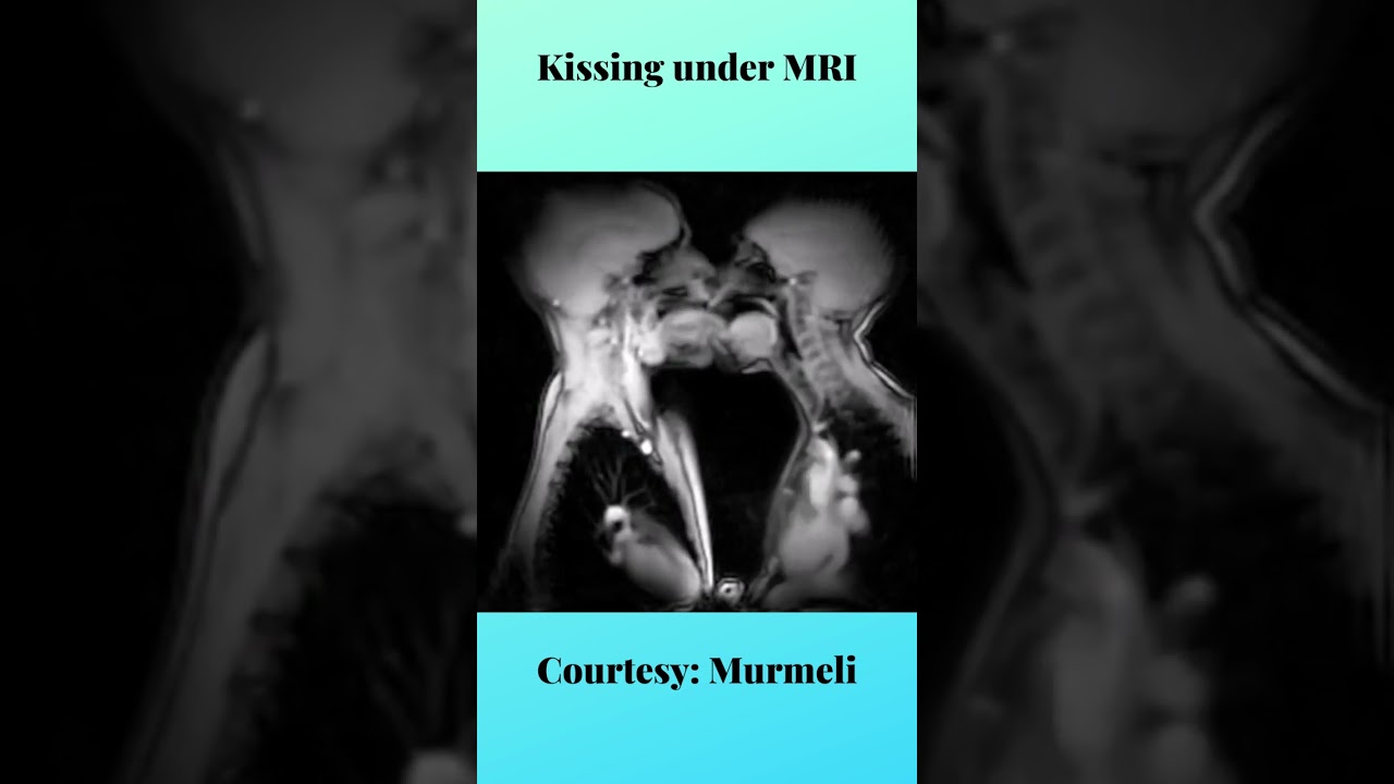 French kissing captured under MRI