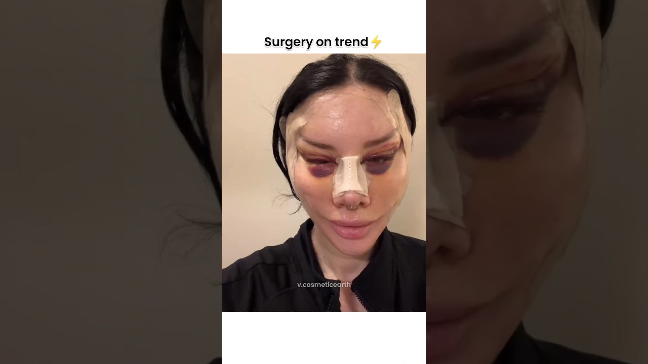 full face surgery😱🔥#shorts #cosmeticsurgery #beauty