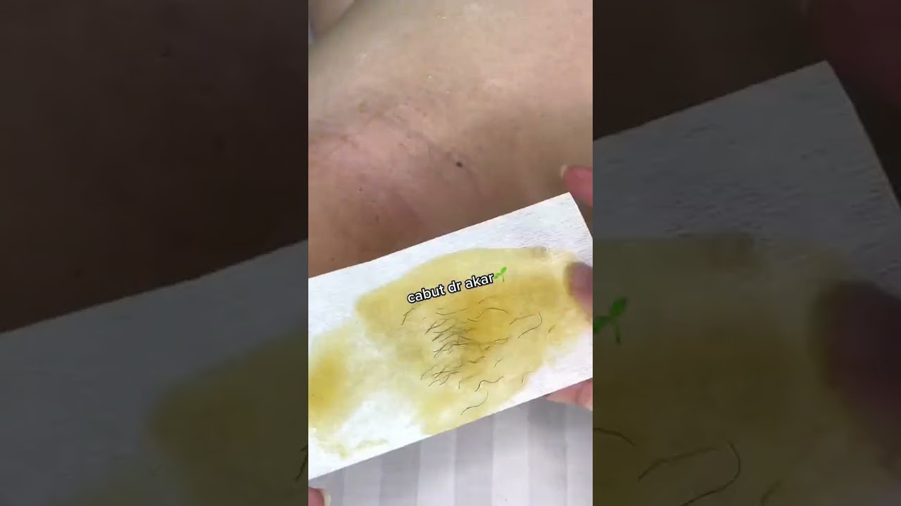 Gatel-gatel di selangkangan??😫