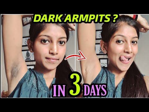 Get Rid of Dark Armpits NATURALLY 😍 100% Works in 3 DAYS