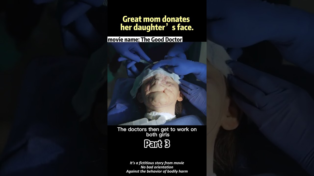 Great mom donates her daughter’s face. #films #movierecap #shortvideo #thegooddoctor