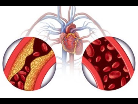 High Blood Pressure and Your Kidneys - A to Z Guide