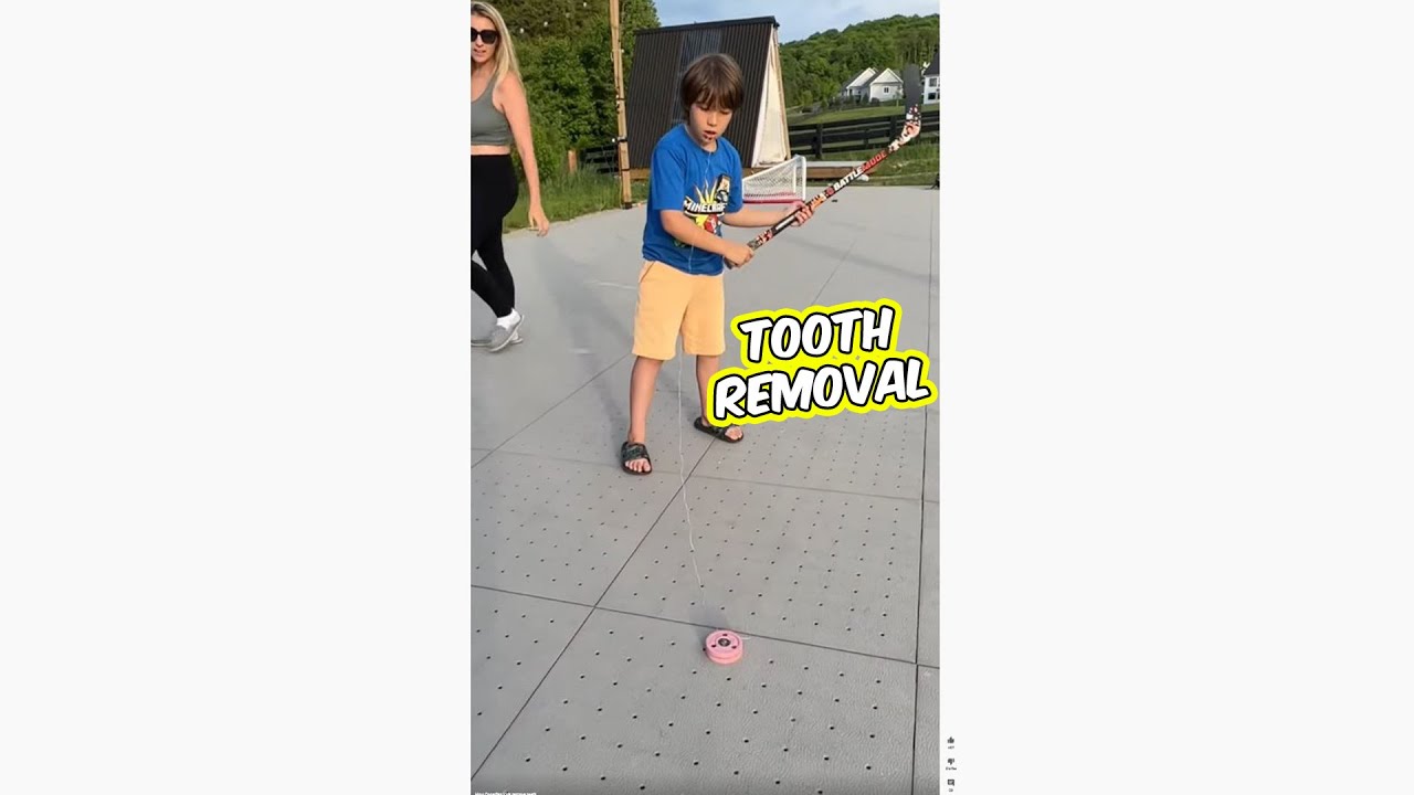 How Canadian kids remove teeth