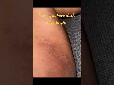 How to get rid of inner thighs darkness #innerthighs #shorts