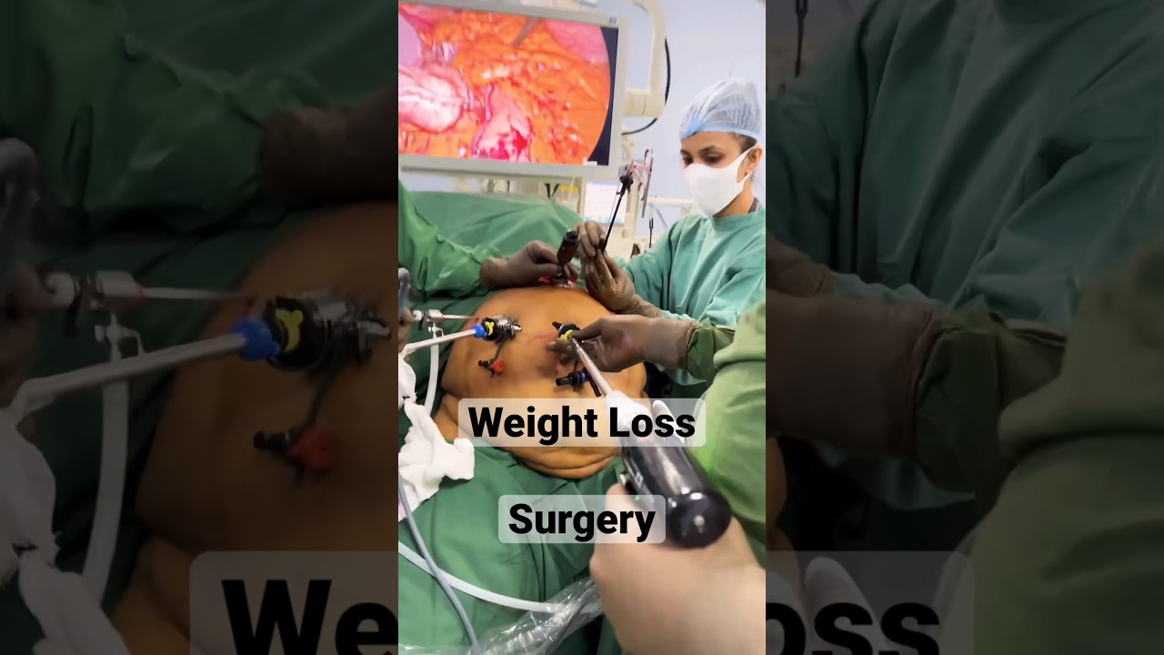 How we do WEIGHT LOSS TREATMENT ? Bariatric Surgery ? Fat removal